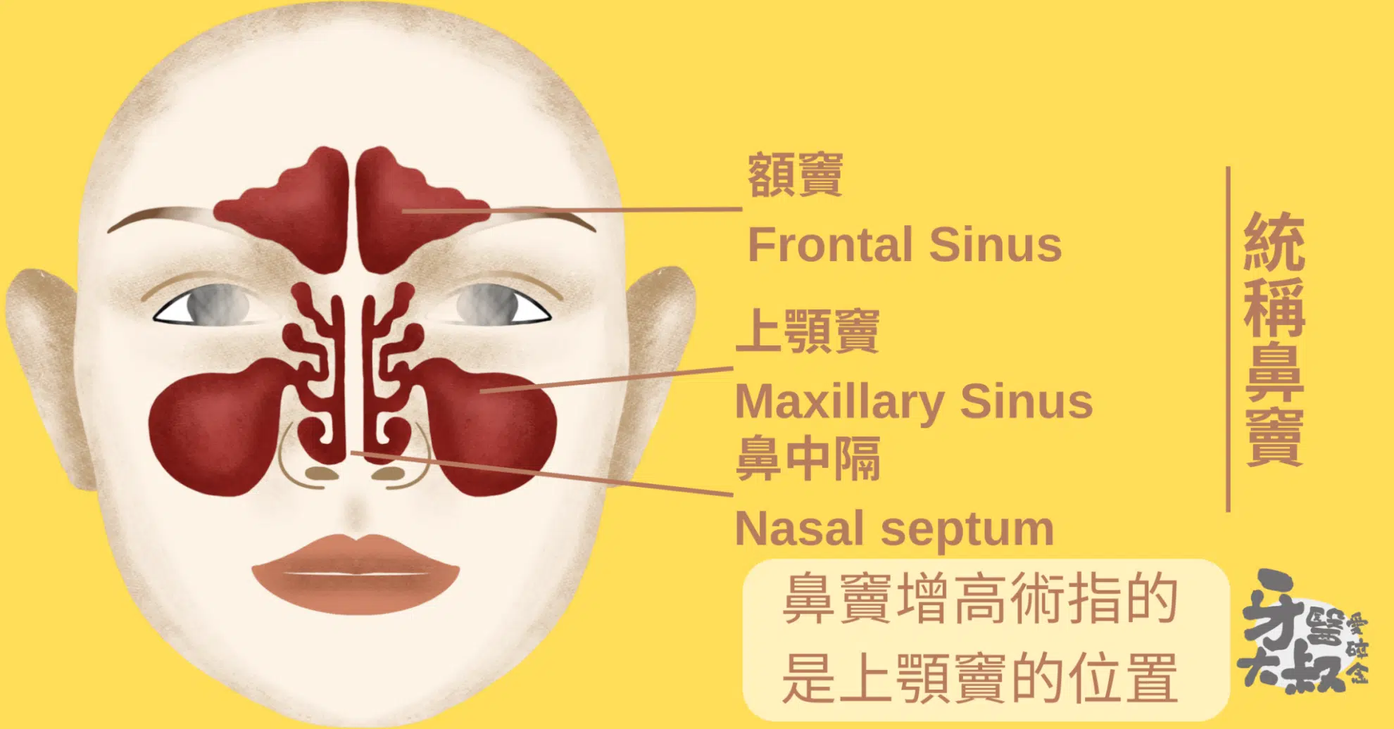 什麼是鼻竇增高術?適合族群、手術流程、風險與費用 什麼是鼻竇增高術?適合族群、手術流程、風險與費用