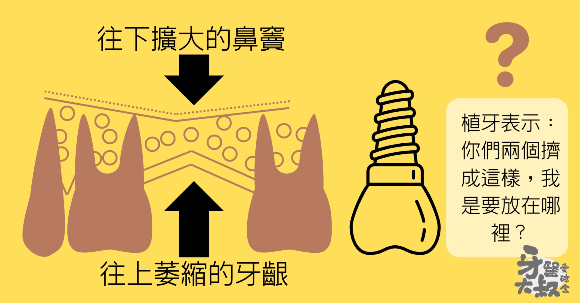 什麼是鼻竇增高術?適合族群、手術流程、風險與費用 什麼是鼻竇增高術?適合族群、手術流程、風險與費用