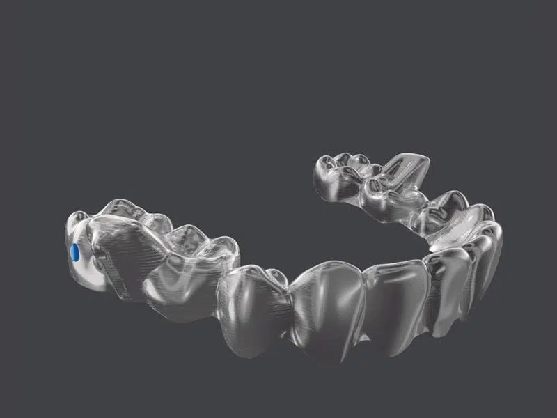 隱適美治療，我該注意什麼？隱適美小叮嚀2：你可能遇到的小裝置