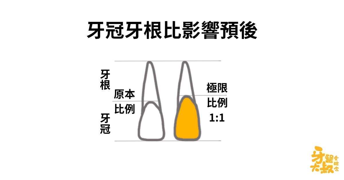 醫師,我牙齒斷了,有救嗎?斷牙怎麼辦 醫師,我牙齒斷了,有救嗎?斷牙怎麼辦