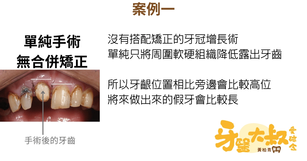 醫師,我牙齒斷了,有救嗎?斷牙怎麼辦 醫師,我牙齒斷了,有救嗎?斷牙怎麼辦