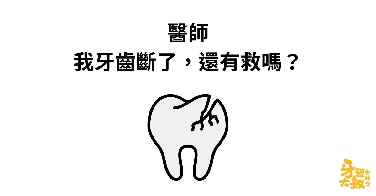 醫師,我牙齒斷了,有救嗎?斷牙怎麼辦 醫師,我牙齒斷了,有救嗎?斷牙怎麼辦