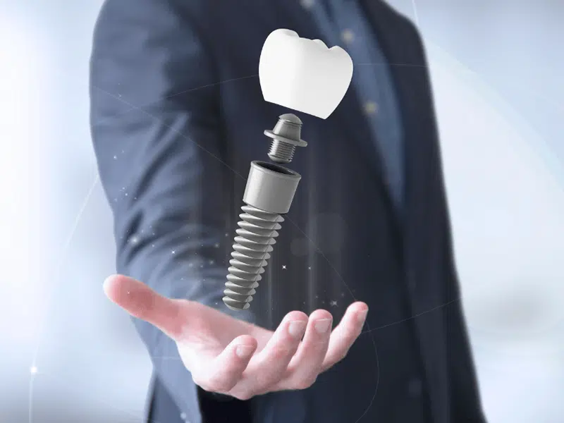 快速搞懂那些植牙名詞：微創植牙、植牙補骨補皮、即拔即植、導板植牙