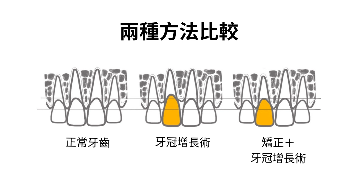 醫師,我牙齒斷了,有救嗎?斷牙怎麼辦 醫師,我牙齒斷了,有救嗎?斷牙怎麼辦