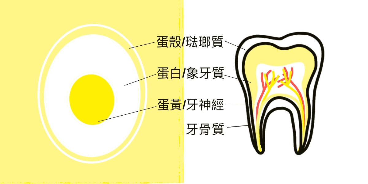 牙齒老是黃黃的,刷不乾淨還容易蛀牙?牙釉質發育不全症 牙齒老是黃黃的,刷不乾淨還容易蛀牙?牙釉質發育不全症
