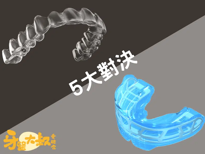 MRC是什麼?一次搞懂兒童隱適美和MRC的5個差別 MRC是什麼?一次搞懂兒童隱適美和MRC的5個差別