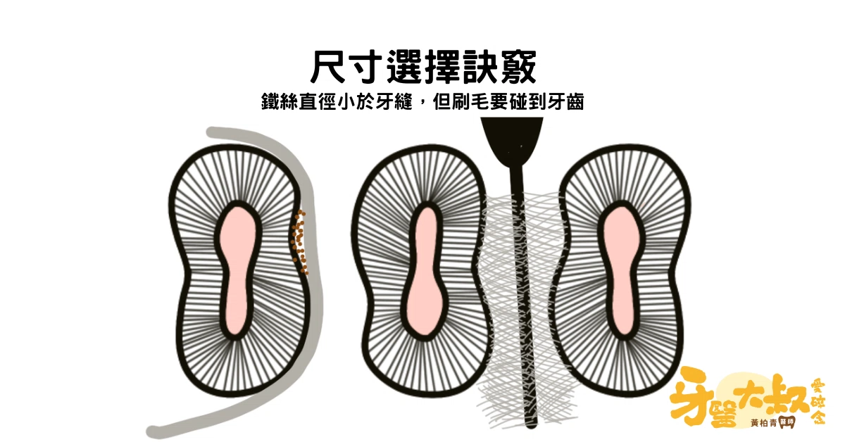 你真的用對牙線了嗎?另外3種你所不知道的特殊牙線 你真的用對牙線了嗎?另外3種你所不知道的特殊牙線