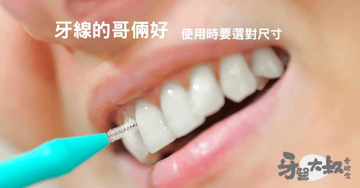 牙間刷的選擇與使用:如何選擇合適大小的牙間刷? 牙間刷的選擇與使用:如何選擇合適大小的牙間刷?