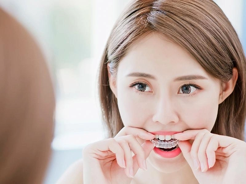 隱適美隱形矯正 隱適美隱形矯正