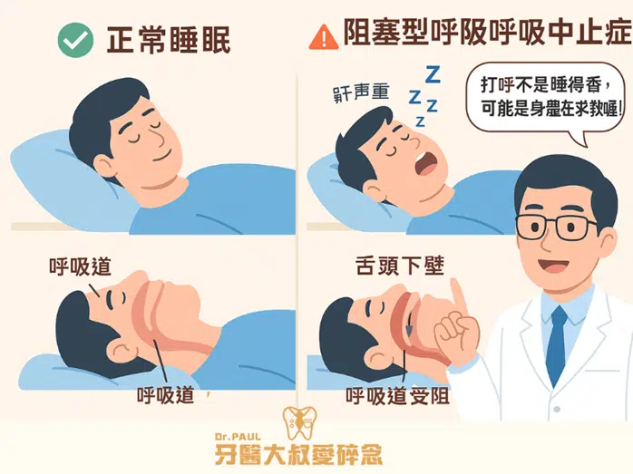 睡眠居家檢測 睡眠居家檢測